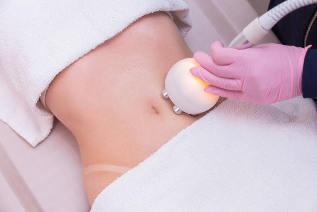 Laser Liposuction | Accumed Center